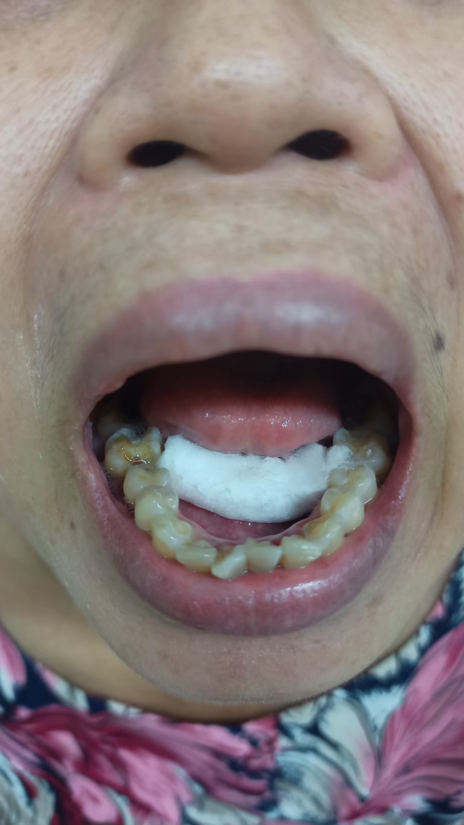 pic_35191